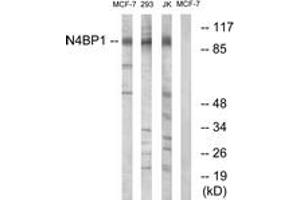Western blot analysis of extracts from MCF-7/Jurkat/293 cells, using N4BP1 Antibody. (N4BP1 antibody  (AA 383-432))