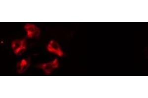 ABIN6277118 staining  HeLa cells by IF/ICC. (Cullin 1 antibody)