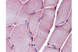 Immunohistochemistry (IHC) image for anti-Sarcoglycan, epsilon (SGCE) (N-Term) antibody (ABIN2782610) (SGCE antibody  (N-Term))