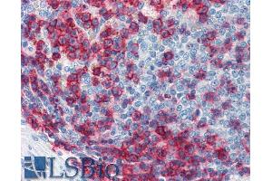 Immunohistochemistry staining of human spleen (paraffin sections) using anti-CD43 (Commercially tested by LifeSpan BioSciences. (CD43 antibody  (FITC))