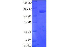SDS-PAGE (SDS) image for Tissue Factor Pathway Inhibitor (Lipoprotein-Associated Coagulation Inhibitor) (TFPI) (AA 29-280), (partial) protein (GST tag) (ABIN1047743)