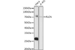 Western blot analysis of extracts of various cell lines, using FLCN antibody (ABIN6133517, ABIN6140670, ABIN6140672 and ABIN6222156) at 1:1000 dilution. (FLCN antibody  (AA 1-342))
