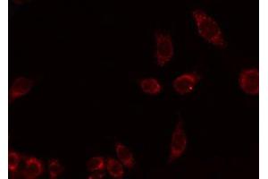 ABIN6275987 staining HuvEc by IF/ICC. (EMR4 antibody)