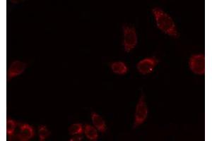 ABIN6275987 staining HuvEc by IF/ICC. (EMR4 antibody)