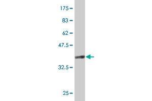 Western Blot detection against Immunogen (37 KDa) . (CD68 antibody  (AA 164-262))