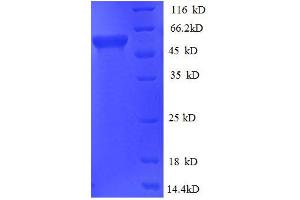 Glycerol kinase (glpK) (AA 1-496) protein (His tag) expressed in E. (Glycerol kinase (glpK) (AA 1-496) protein (His tag))