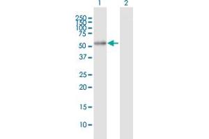 Western Blot analysis of ALDH7A1 expression in transfected 293T cell line by ALDH7A1 MaxPab polyclonal antibody. (ALDH7A1 antibody  (AA 1-511))