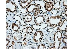 Immunohistochemical staining of paraffin-embedded Kidney tissue using anti-KIAA1609 mouse monoclonal antibody. (KIAA1609 antibody)
