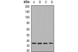 Western blot analysis of TIRAP expression in HT29 (A), SW480 (B), mouse liver (C), mouse brain (D) whole cell lysates. (TIRAP antibody)