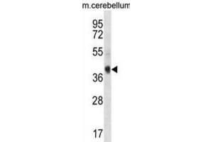 Western Blotting (WB) image for anti-AKT Interacting Protein (AKTIP) antibody (ABIN3000901)