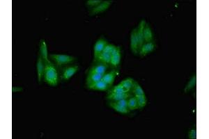 Immunofluorescent analysis of HepG2 cells using ABIN7154951 at dilution of 1:100 and Alexa Fluor 488-congugated AffiniPure Goat Anti-Rabbit IgG(H+L) (HMOX1 antibody  (AA 3-288))