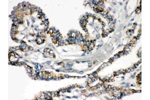 IHC analysis of Bik using anti-Bik antibody (ABIN3043509). (BIK antibody  (AA 1-123))