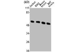 Western Blot analysis of Jurkat K562 MOUSE-BRAIN RAT-BRAIN cells using Tubulin β Polyclonal Antibody (TUBB3 antibody  (C-Term))