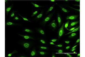 Immunofluorescence of monoclonal antibody to OXSR1 on HeLa cell. (OXSR1 antibody  (AA 351-450))