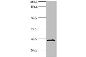 Western blot All lanes: MIS12 antibody at 2 μg/mL + Hela whole cell lysate Secondary Goat polyclonal to rabbit IgG at 1/10000 dilution Predicted band size: 25 kDa Observed band size: 25 kDa