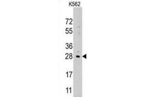 Western Blotting (WB) image for anti-Lin-28 Homolog B (LIN28B) antibody (ABIN2937586) (LIN28B antibody)