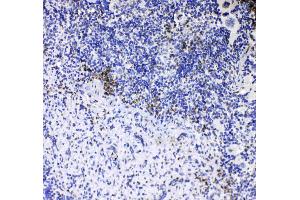 IHC analysis of CD8 alpha using anti-CD8 alpha antibody . (CD8 alpha antibody  (AA 28-196))
