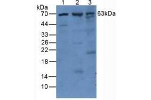 Western blot analysis of (1) Human Mcf7 Cells, (2) Mouse Pancreas Tissue and (3) Mouse Kidney Tissue.