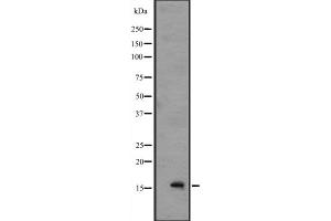 Western blot analysis of IL1F8 expression in A549 cell lysate with blocking peptide,The lane on the left is treated with the antigen-specific peptide. (FIL1h antibody  (C-Term))