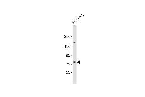 Anti-SLC6A8 Antibody (N-Term) at 1:2000 dilution + mouse heart lysate Lysates/proteins at 20 μg per lane. (SLC6A8 antibody  (AA 180-212))