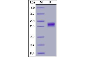 Human FOLR1, His Tag on  under reducing (R) condition. (FOLR1 Protein (AA 25-233) (His tag))