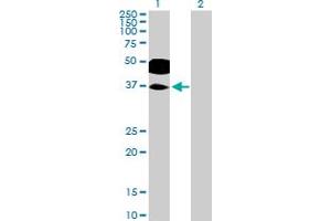 Western Blot analysis of RHOXF2 expression in transfected 293T cell line by RHOXF2 MaxPab polyclonal antibody. (RHOXF2 antibody  (AA 1-288))