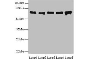 Western blot All lanes: SPDL1 antibody at 4 μg/mL Lane 1: Hela whole cell lysate Lane 2: 293T whole cell lysate Lane 3: Jurkat whole cell lysate Lane 4: A549 whole cell lysate Lane 5: K562 whole cell lysate Secondary Goat polyclonal to rabbit IgG at 1/10000 dilution Predicted band size: 71, 59, 62 kDa Observed band size: 71 kDa