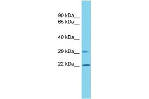 Western Blotting (WB) image for anti-Vacuolar Protein-Sorting-Associated Protein 25 (VPS25) (C-Term) antibody (ABIN2788482)