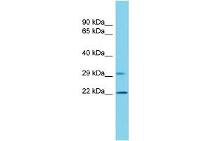 Host: Rabbit  Target Name: Vps25  Sample Tissue: Rat Pancreas lysates  Antibody Dilution: 1. (VPS25 antibody  (C-Term))