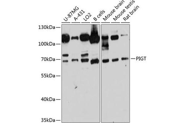 PIGT Antikörper  (AA 260-460)