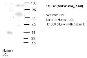 Image no. 2 for anti-Oligodendrocyte Lineage Transcription Factor 2 (OLIG2) (N-Term) antibody (ABIN309608)