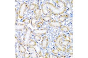 Immunohistochemistry of paraffin-embedded rat kidney using WRB antibody at dilution of 1:200 (40x lens).