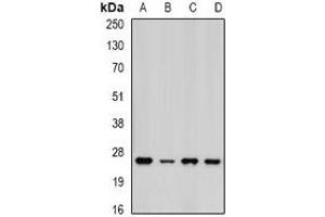 Western blot analysis of PSMA5 expression in MCF7 (A), HepG2 (B), mouse liver (C), mouse heart (D) whole cell lysates.