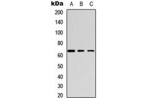 Western blot analysis of GABRB1 (pS434) expression in HeLa (A), mouse brain (B), rat brain (C) whole cell lysates.