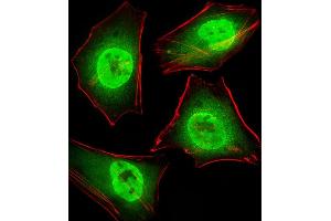 Fluorescent image of Hela cells stained with GTF2I Antibody (C-term) (ABIN390868 and ABIN2841085). (GTF2I antibody  (C-Term))