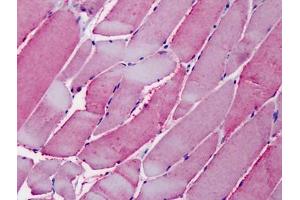 Human Skeletal Muscle: Formalin-Fixed, Paraffin-Embedded (FFPE) (OSBPL1A antibody  (C-Term))
