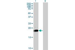 Western Blot analysis of NPC2 expression in transfected 293T cell line by NPC2 monoclonal antibody (M01), clone 4B9. (NPC2 antibody  (AA 1-151))