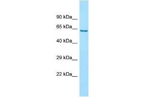 WB Suggested Anti-ANKFY1 Antibody Titration: 1. (ANKFY1 antibody  (C-Term))