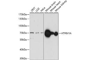 Western blot analysis of extracts of various cell lines, using V1A antibody (ABIN7265765) at 1:1000 dilution. (ATP6V1A antibody  (AA 500-600))