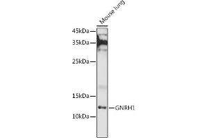 Western blot analysis of extracts of Mouse lung, using GNRH1 antibody (ABIN6131875, ABIN6141257, ABIN6141258 and ABIN6221260) at 1:1000 dilution. (GNRH1 antibody  (AA 24-92))