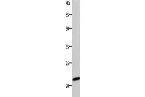 Western Blotting (WB) image for anti-Deoxyuridine Triphosphatase (DUT) antibody (ABIN2425781) (Deoxyuridine Triphosphatase (DUT) antibody)