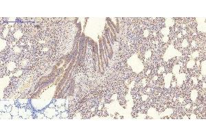 Immunohistochemistry of paraffin-embedded Rat lung tissue using COL4A1 Monoclonal Antibody at dilution of 1:200. (COL4A1 antibody)