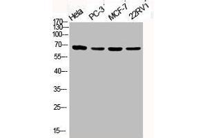 Western Blot analysis of HELA PC3 MCF7 22RV1 cells using Phospho-PKC ζ (T410) Polyclonal Antibody (PKC zeta antibody  (pThr410))