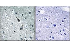 Immunohistochemistry analysis of paraffin-embedded human brain tissue, using 5-HT-2A Antibody. (HTR2A antibody  (AA 422-471))