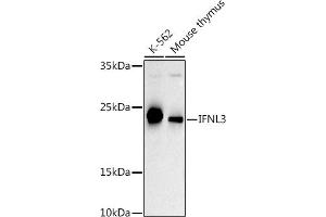 Western blot analysis of extracts of various cell lines, using IFNL3 antibody (ABIN6132858, ABIN6142207, ABIN6142209 and ABIN6221289) at 1:500 dilution. (IL28B antibody  (AA 22-196))