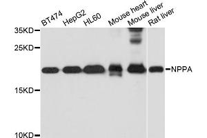 Western blot analysis of extracts of various cell lines, using NPPA antibody. (NPPA antibody)