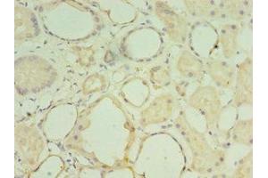 Immunohistochemistry of paraffin-embedded human kidney tissue using ABIN7159050 at dilution of 1:100 (Matrilin 3 antibody  (AA 277-486))