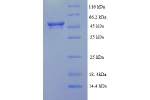 SDS-PAGE (SDS) image for Aldehyde Dehydrogenase 5 Family, Member A1 (ALDH5A1) (AA 48-535) protein (His tag) (ABIN5713214) (ALDH5A1 Protein (AA 48-535) (His tag))