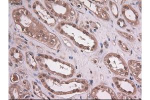 Image no. 2 for anti-Epithelial Cell Adhesion Molecule (EPCAM) (AA 24-265) antibody (ABIN1491256)