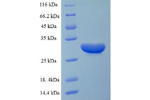 SDS-PAGE (SDS) image for Receptor (TNFRSF)-Interacting serine-threonine Kinase 1 (RIPK1) (AA 24-269) protein (His tag) (ABIN5714046) (RIPK1 Protein (AA 24-269) (His tag))